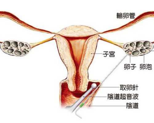 温州供精费用 温州做试管婴儿需要做哪些检查? ‘怀孕b超图形看男女’