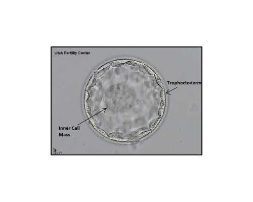 重庆国内代孕网站,试管婴儿移植十天能测出好孕吗？冻胚不是说比鲜的着床晚