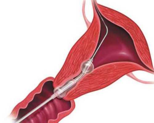 重庆有医院供卵吗,试管婴儿对女人身体“伤害”有多大？医生说出了实话，别