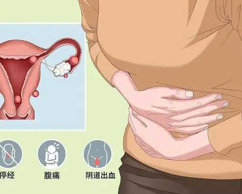 重庆代孕哪里放心,重庆做试管婴儿最好的医院是哪个？希望各位给点建议。_孕