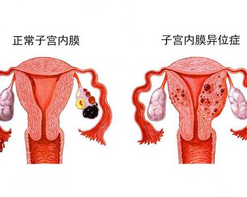 重庆商业代孕危害|南通供卵试管助孕生子医院排名