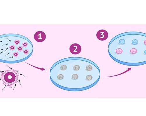 重庆找人代生孩子,重庆试管婴儿收费标准是怎样？