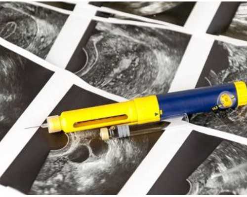 重庆代孕服务的方式|南京助孕机构，盛大三代试管助孕胚胎筛查一个胚胎多少