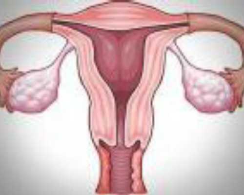 上环后可以干家务吗（上环前注意事项）