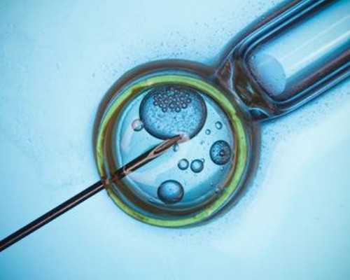 重庆借卵供卵中心,重庆做试管婴儿大概多少钱？试管会不会很贵？_移植前打贝