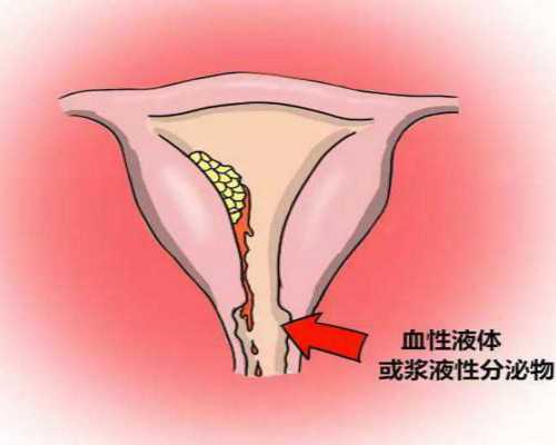 重庆代孕价格哪里便宜|张家界三代试管费用选男女？张家界生殖保健医院怎么