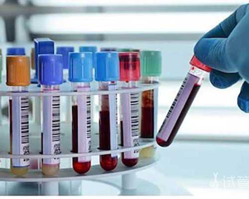 重庆借卵代怀费用,重庆做试管婴儿的专业机构:宫颈炎的早期症状有哪些?