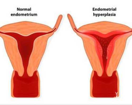 重庆代生哪里技术好,分享给大家!北京三代试管多少钱?-试管移植后肚子有下坠