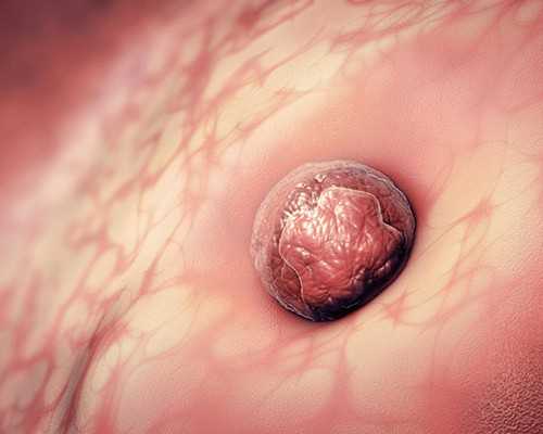 重庆医院代孕费用,哪些人适合试管婴儿？美国试管婴儿有哪些步骤？_试管后可