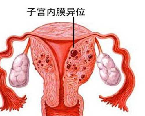 重庆未婚女助孕公司,重庆湘雅附一生殖中心做试管婴儿取卵会打麻药吗？