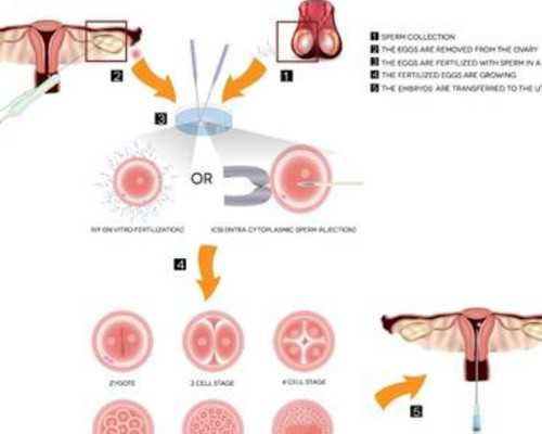 专家解读b级精子可以做试管婴儿-来自于科技助孕带给男性的福利