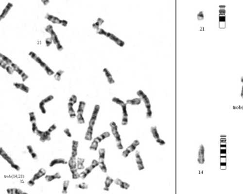重庆代生中心,山大生殖做试管婴儿费用大概要多少钱？5万元够吗？-上海供卵试