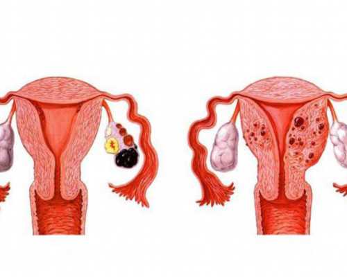 重庆代生收费多少,北京试管婴儿医院取卵少的原因-试管胎停一定要清宫吗孕妇