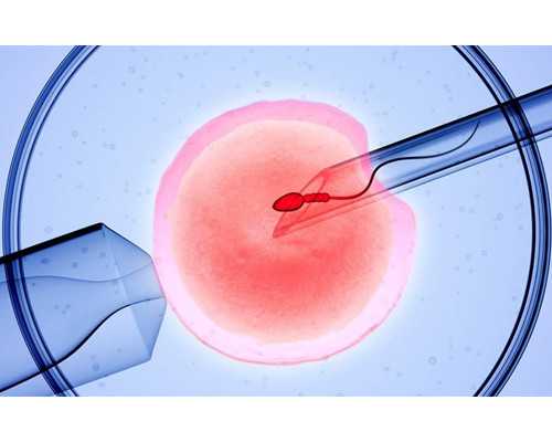 重庆同性供卵试管,日本大阪试管婴儿技术成熟吗？_柳州妇科医院_遵义医学院和