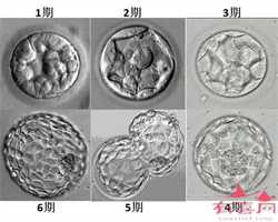 重庆专业的合法代孕_重庆有没代孕的呀_中国助孕机构排名-1626756079892