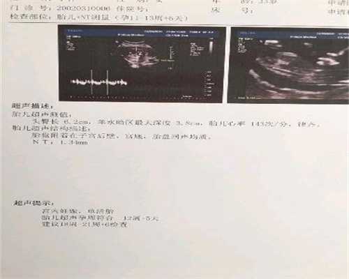 重庆第三代试管婴儿hcg_重庆代孕生子的意思_天若助孕-排卵针多少钱一针