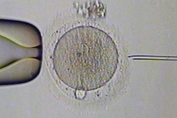 重庆助孕优生工程_重庆代生_泰国试管婴儿基因检测对囊胚有伤害吗？基因检测