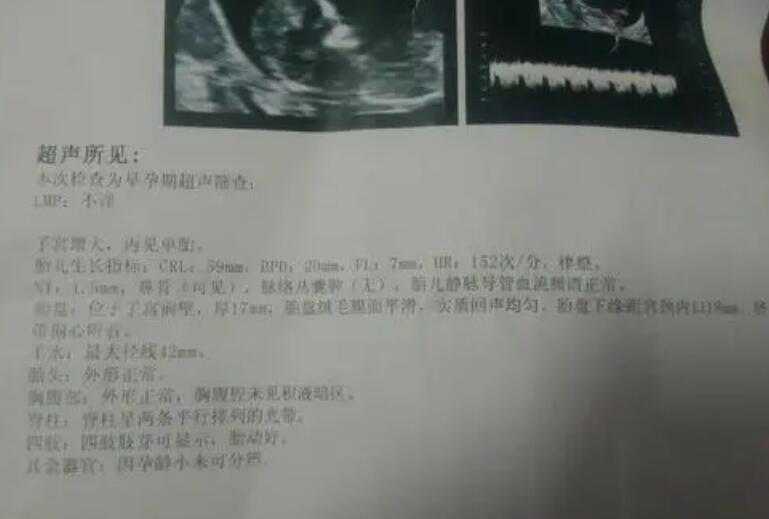 重庆助孕可以选择性别 在重庆妇幼保健院申请供精试管助孕要多久才有精源？