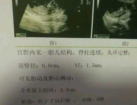 重庆供精供卵试管医院 重庆七星岗妇幼做试管的经历 ‘怀男宝宝妈妈特征’